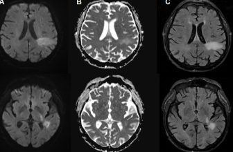 You're likely already infected with a brain-eating virus you've never heard of